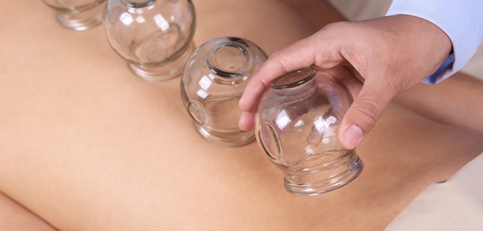 cupping_therapy